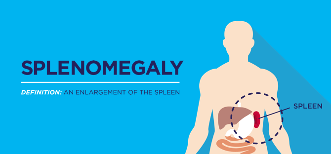 mpn-patient-know-about-spleen-Mobile-Tile