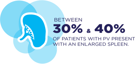 Graphic icon of a spleen with text that says – BETWEEN 30% & 40% OF PATIENTS WITH PV PRESENT WITH AN ENLARGED SPLEEN