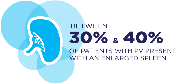 Graphic icon of a spleen with text that says – BETWEEN 30% & 40% OF PATIENTS WITH PV PRESENT WITH AN ENLARGED SPLEEN